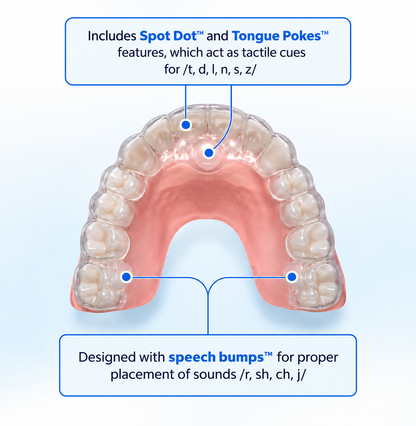 Speech Pal™ Tongue Training Appliance